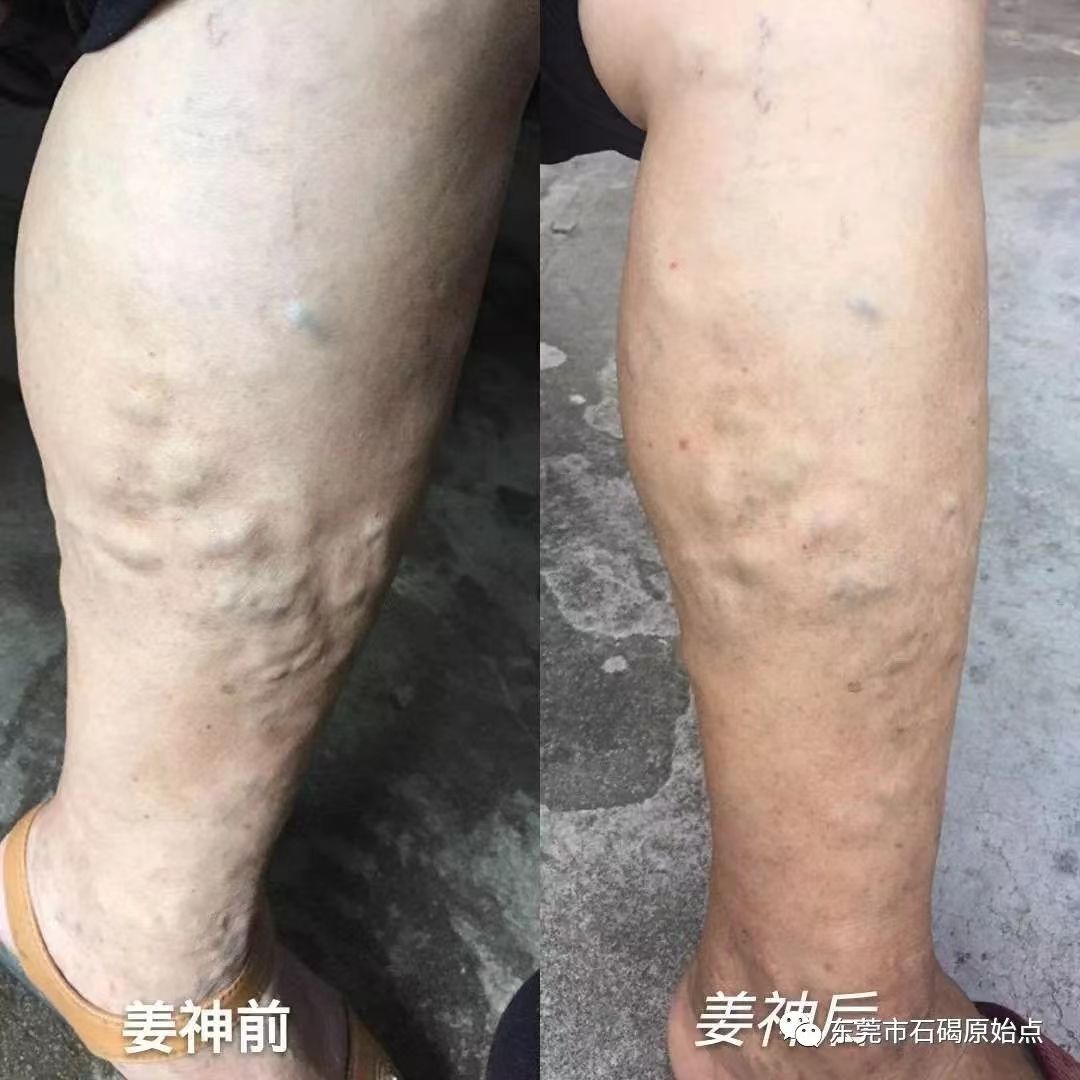 微信图片_20220827091903 微信图片_20220827091903
