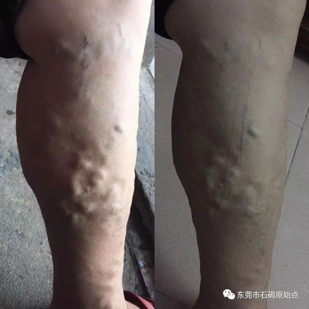 微信图片_20220827091853 微信图片_20220827091853