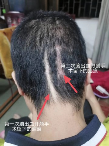 格式工厂微信图片_20231214093258